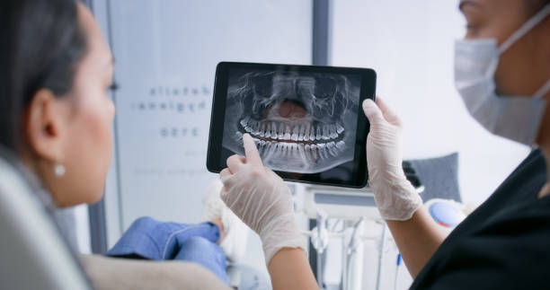 Licensed Dental Implants service in Mechanicsburg, OH - Smile Center Dentistry